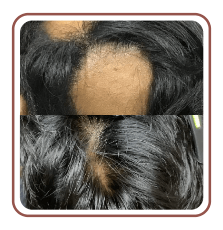 beforeafter02