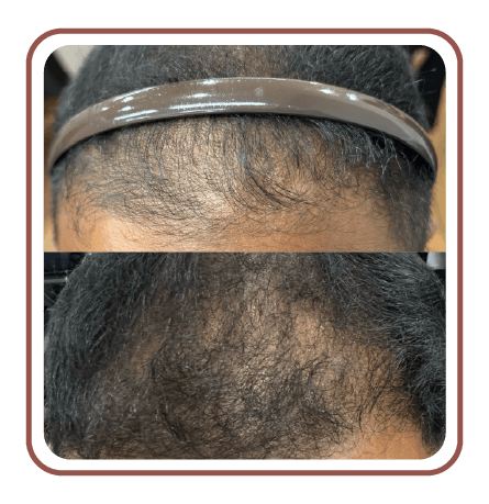 beforeafter03