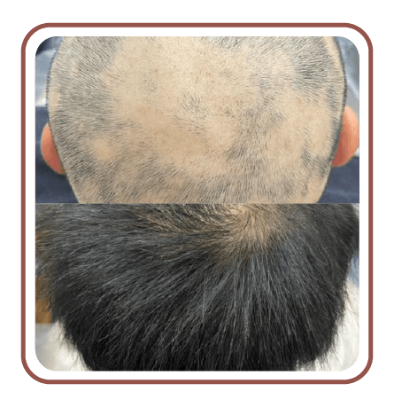 beforeafter05
