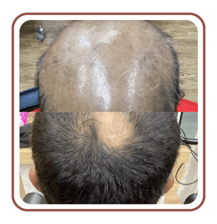 beforeafter06