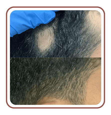 beforeafter07